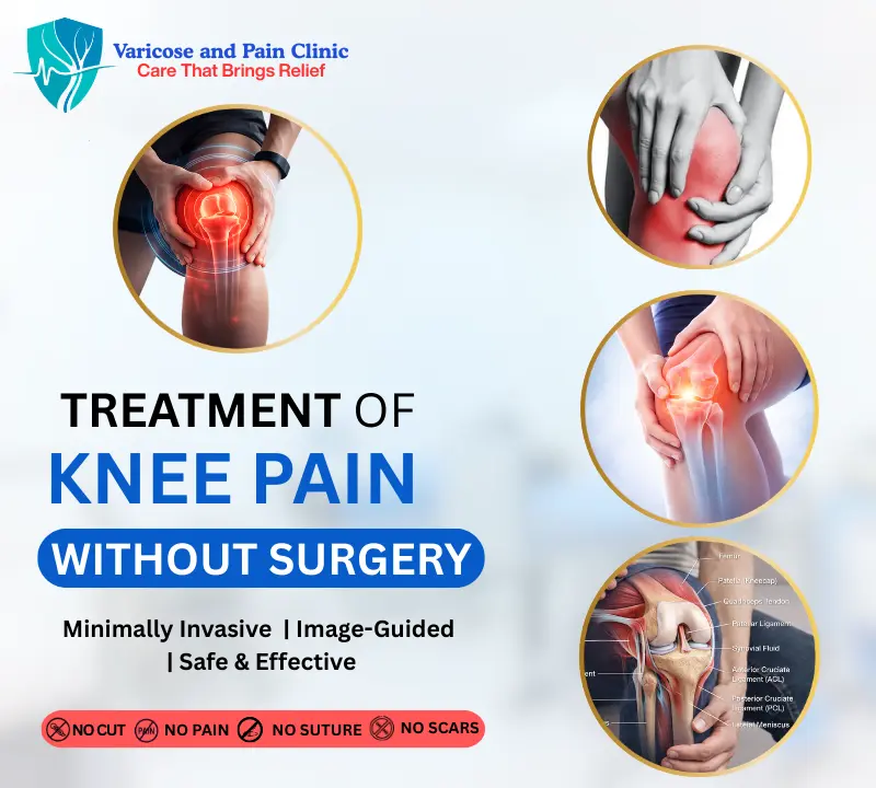 Advanced non-surgical treatment for varicose veins and pain conditions at Varicose & Pain Clinic using minimally invasive techniques