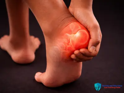 Heel pain with highlighted inflammation showing foot pain and plantar area discomfort