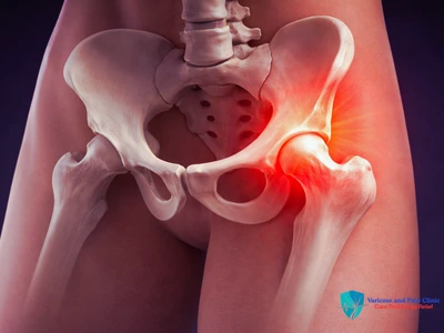Hip joint pain area highlighted showing inflammation and joint discomfort